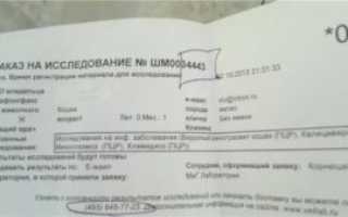 Расшифровка анализа на иерсиниоз
