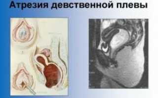 Может ли девственная плева срастись?