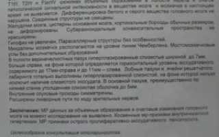 Пояснение заключения МРТ