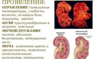 Болит желудок и поднялась температура