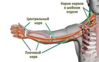 После наркоза сильно болит левая рука от предплечья до пальцев