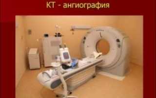 Что лучше — бронхоскопия или томография?