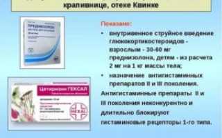 Как принимать дексаметазон при крапивнице?