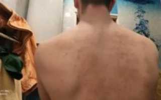 Зеленое пятно на спине