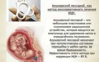 Как ухаживать за пессарием дома?