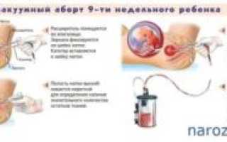 Баня после аборта