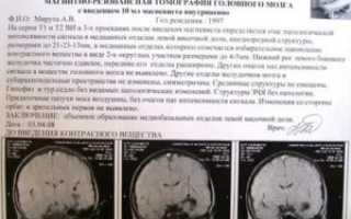 Расшифровка МРТ, как лечить